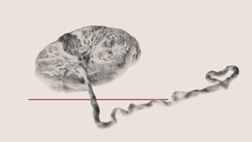 placenta
